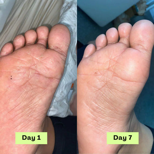 Vitae+ Anti Fungus Soap